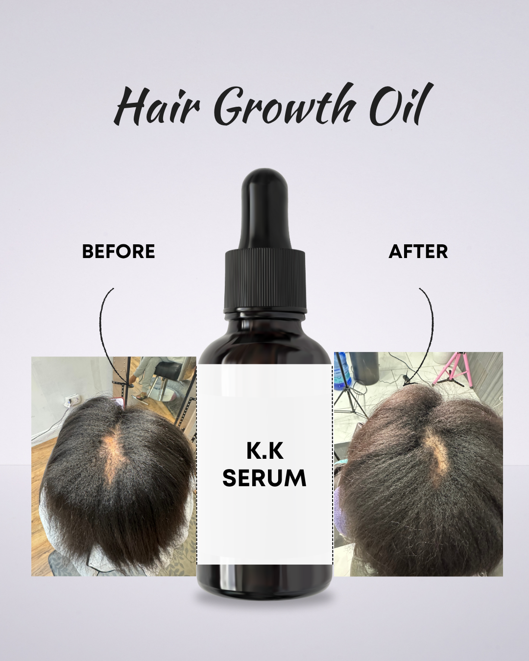 HAIR GROWTH OIL
