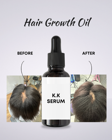 HAIR GROWTH OIL